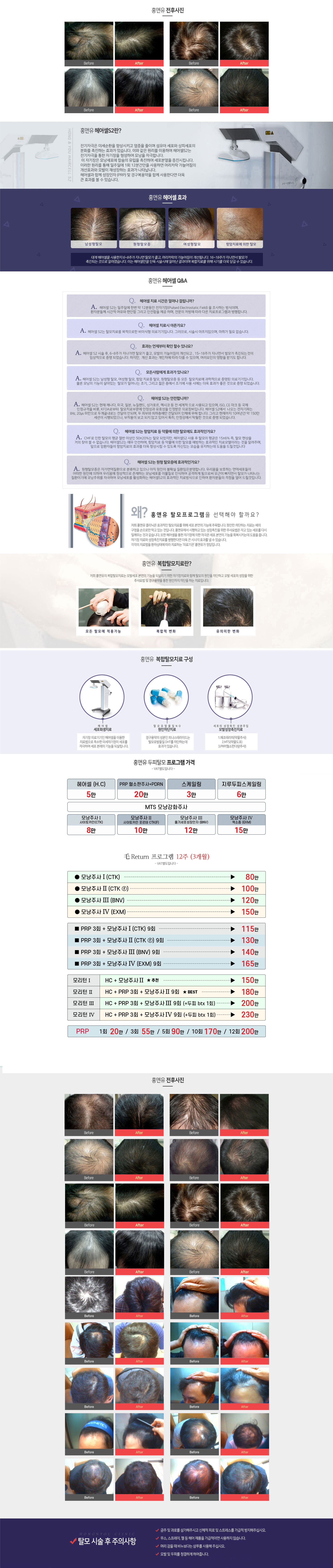 서브 콘텐츠 이미지