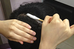 스케일링제 도포